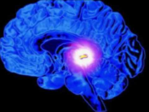 Dr. Manfred Doepp about the Pineal Gland & 4G Wireless Assault