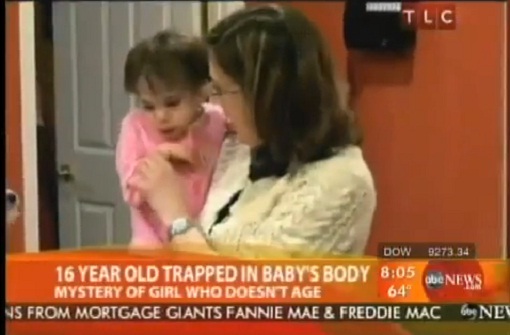 Medical Mystery – 16 Year Old ‘Baby’ Doesn’t Age