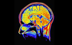 Brain Study Shows Why Some People Are More In Tune With What They Want